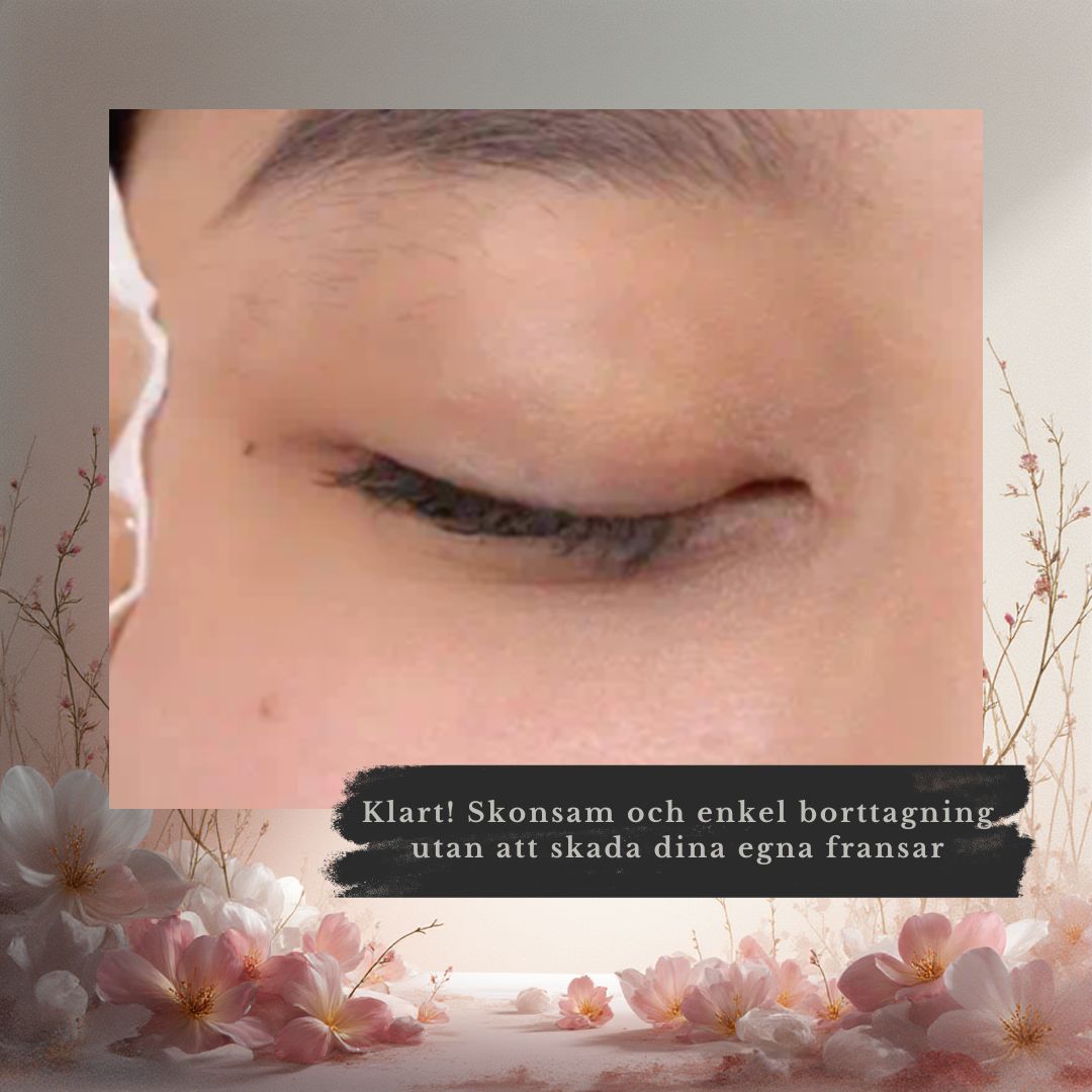 Fransremover - Bild 6